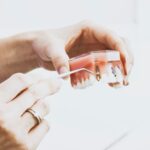 Mentoring in implant dentistry