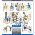 New PDJ online: Implant dentistry (part one)