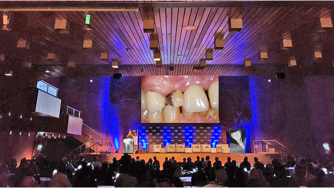 Occlusion and perio symposia for early career dentists