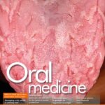 New PDJ online: Oral medicine